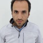 کاشت مو سنندج