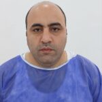 کاشت مو در سنندج