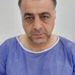 نمونه کار کاشت مو در سنندج